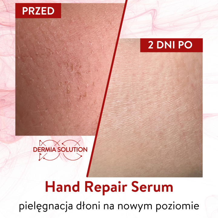 Hand Repair Serum 50 ml Refill